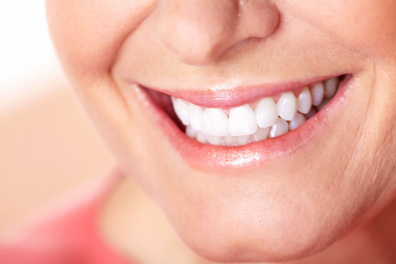 North York Dentist - Cosmetic Bonding - woman smiling