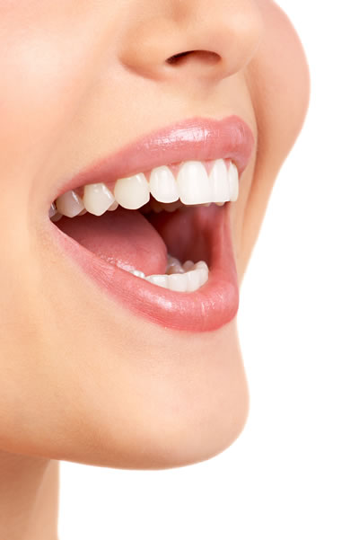 Tooth Colored Fillings - woman smiling showing beautiful teeth