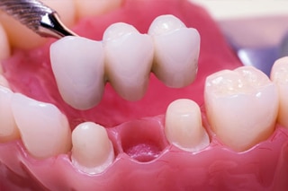 Dentistry On Wilson - Canadian Dental Care Plan