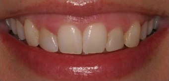 Oral Surgery - Periondontal - Before photo